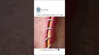 🧵✂️ كيف تعمل الغرز الجراحية؟ 🌟