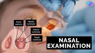 Nasal Examination | Nose Examination | OSCE Guide | UKMLA | CPSA | PLAB 2