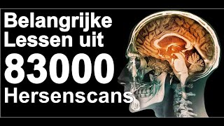 Belangrijke lessen uit 83000 hersenscans (Spectscan)