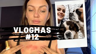 Vlogmas2020 PROPAO! Reakcija na STRES, moji psi i operacije | Jasmina Skender