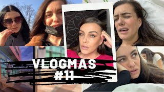 Vlogmas2020 #11 | ISTINA o laserskoj epilaciji! | Jasmina Skender