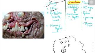 KROK 1| pathomorphology mcq explanations | part 5