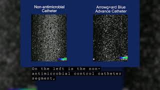 Arrowg+ard Blue Advance (AGBA) Biofilm Video