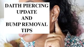 DAITH PIERCING UPDATE /TIPS ON BUMP REMOVAL