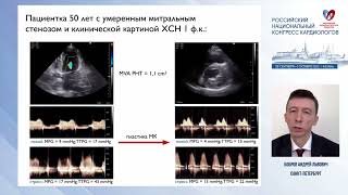 Стресс-эхокардиография у пациентов с приобретёнными пороками сердца