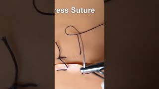 177.surgical mattress suture #skill learning medicine. #how to put surgical suture #dentist #suture