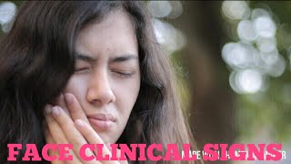 5._Face_Clinical_Signs_-_GP_Clinics_-_Dr._Vaidya(360p).mp4 August 19, 2020