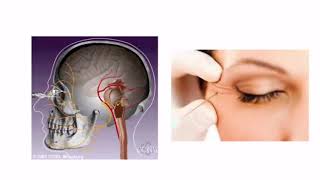 Hemifacial Spasm with Dr. Dong Kim