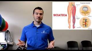 Sciatica Imposters