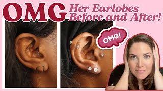 The 60-Minute Earlobe Transformation You Need to See