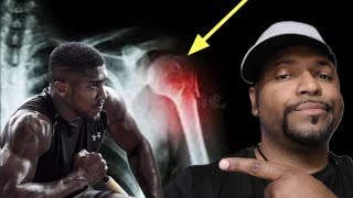 BREAKING NEWS❗🚨 FINALLY ANTHONY JOSHUA'S INJURIES REVEALED ❗🚨