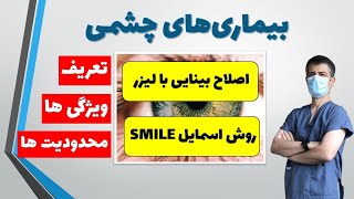 اصلاح دید با کمک لیزر از روش اسمایل (SMILE): تعریف، مزایا و محدودیت ها