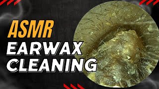 ASMR Real Doctor Do Ear Cleaning