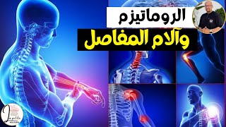 وصفة مساعدة لعلاج الروماتيزم وآلام المفاصل والروماتويد الدكتور عماد ميزاب Docteur Imad Mizab