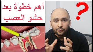 نصائح بعد حشو العصب. ليه تعمل طربوش بعد حشو العصب؟ وامته تحتاج دعامة أسنان؟