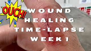 Wound Healing Time Lapse Week 1