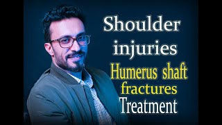 16 Shoulder injuries: Humerus shaft fractures treatment