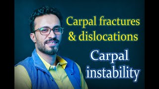 05 Carpal fractures & dislocations: Carpal instability