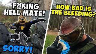 PAINTBALL INJURIES, FAILS  & FUNNY MOMENTS 😱 ► BEST PAINTBALL MOMENTS OF 2022