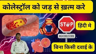 कोलेस्ट्रॉल (Cholesterol) | कोलेस्ट्रॉल से पाए  छुटकारा | टॉप आयुर्वेदिक होम रेमेडी