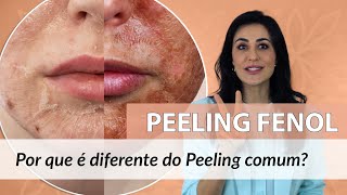 Qual a diferença do Peeling de Fenol para o Peeling comum?