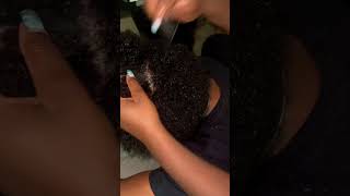 Dandruff Scratching | Big Flakes | Scalp Dandruff #dandruff #dandruffremoval #itchyscalp