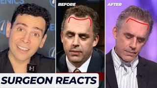 Did Jordan Peterson get a hair transplant? SURGEON REACTS 😯