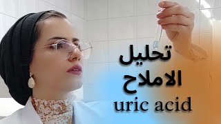 تحليل الاملاح (اليورك اسد uric acid) بالطريقة الصحيحة ، بايوكمستري 5