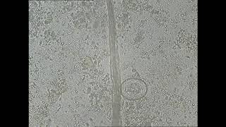 Fast scanning microscope to find H nana ova 40x (finding Tapeworm ovum)