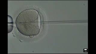 ICSI embryo - SRM Embryology Lab video