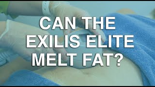 Can the Exilis Elite melt fat? | The Body Clinic | Exilis Elite Fat Reduction FAQ 🎯