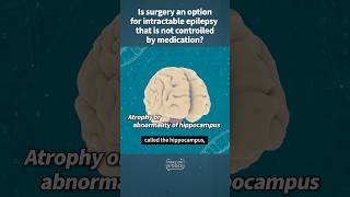 Is surgery an option for intractable epilepsy that is not controlled by medication?