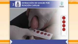 Extracción de sangre por punción capilar