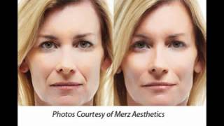 Cosmetic Dermatology Santa Monica, Botox, Radiesse, Restylane, Juvederm