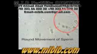 round movement of sperm ,abnormal sperm video