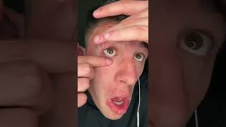 My eye #humor #memes #comedy #comedyvideos @🤣🤣🤣@shorts