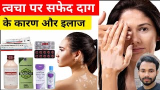 त्वचा पर सफेद दाग के कारण और इलाज // Leucoderma treatment// Treatment Of White Patches// #leucoderma