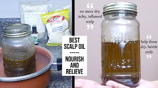 How to: Extreme scalp relief and hair growth oil | Nourishing dry & itchy/inflamed scalp