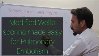 Modified Well's scoring for Pulmonary Embolism