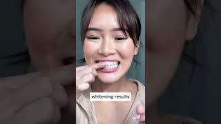 30 minutes to a brighter, confident smile! 💫 #asmr #trendingproducts #teethwhiteningcare #teeth