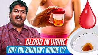 Blood in Urine: Why You Shouldn't Ignore It | Dr. Venkat Subramaniam | AINU Chennai