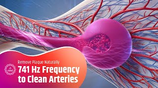 741 Hz Frequency to Clean Arteries | Enhance Blood Flow and Remove Plaque Naturally