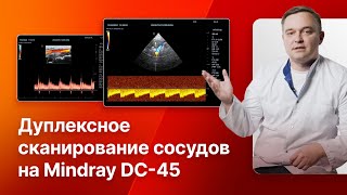 Дуплексное сканирование сосудов шеи, головного мозга, брюшной аорты и ветвей на Mindray DC-45