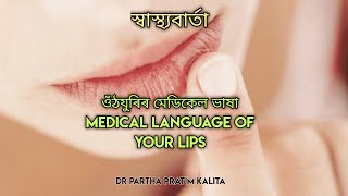 ওঁঠযুৰিৰ মেডিকেল ভাষা ll MEDICAL LANGUAGE OF YOUR LIPS ll স্বাস্থ্যবাৰ্তা