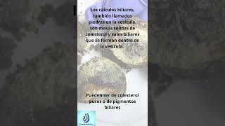 Vesicula biliar y calculos. #vesículabiliar#cálculosbiliares#vesícula#bilis#piedrasvesícula