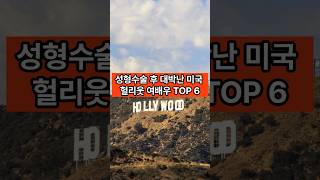 성형수술 후 대박난 헐리웃 여배우 TOP 6