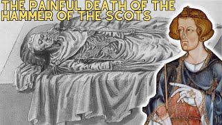 The PAINFUL Death Of The Hammer Of The Scots - King Edward I