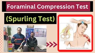 Spurling Test-Foraminal Compression Test|Cervical pain|Nerve root Pain|Physiotherpy|healtheducatum