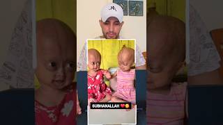 Ya Allah give to them Health || Sehat selalu yah dek || God Bless you  #viral #shorts #youtubeshorts