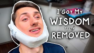 Extracting Wisdom Via Teeth (Wisdom Teeth Removal)